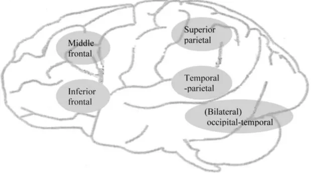 Figure 1. A coarse schematic of the left hemisphere (LH) reading network for Chinese reading showing points of departure from the alphabetic reading network