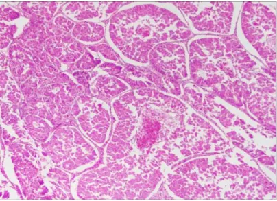 Fig. 2: Photomicrograph showing secretory endometrium. (40X, H&E) 