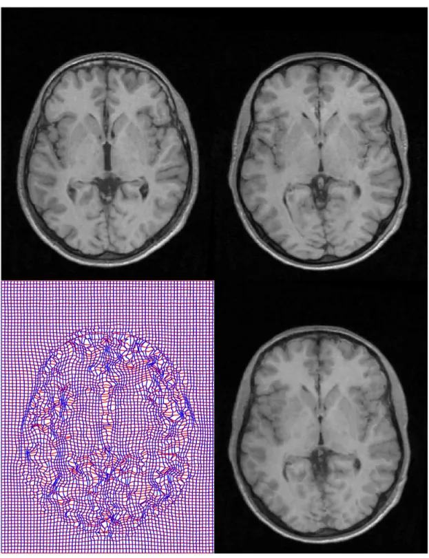 Figure 4.10: Above left : the unwarped source image. Above right : the template image