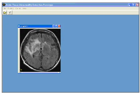 Figure 2.4 : Brain Slice Selection  