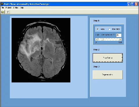 Figure 2.6: Cortical Removal 