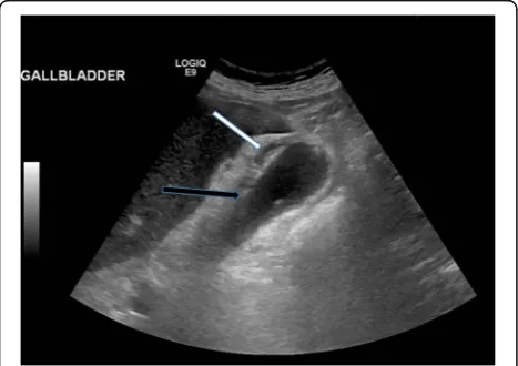 Fig. 8 Illustration outlines the multitude of locations within the digestive tract where gallstones can manifest and lists the pathological processesthat occur in these locations
