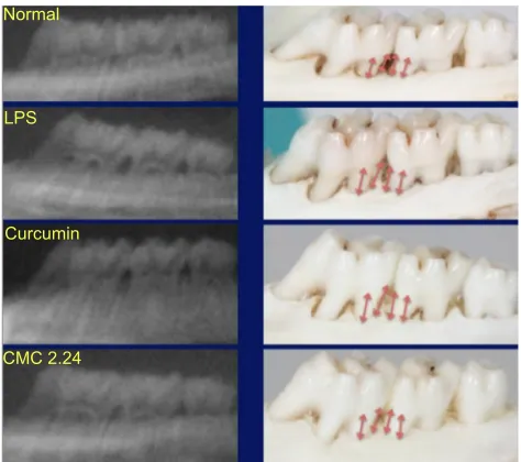 Figure 11 representative periapical radiographs and morphometric images of each group.Abbreviations: CMC, chemically modified curcumin; LPS, lipopolysaccharide.
