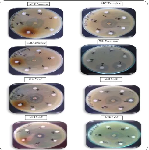 Fig. 7: Antibacterial activity of different samples of titanium dioxide nanoparticles,) against P