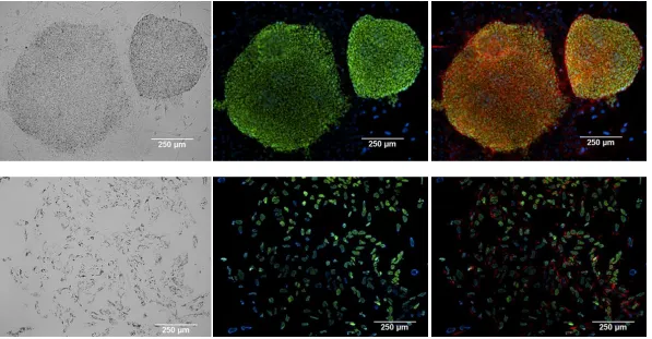 Figure 2.2: Top images showing H9 embryonic stem cell colonies with brightfield image, pluripotency marker Oct4 with DAPI, and merged image showing cytoskeletal marker F-actin, DAPI, and OCT4 (right to left)