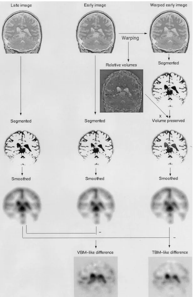 FIG. 1. Illustration of the continuum between VBM and TBM. The center column illustrates a VBM processing stream, whereas the column on the right illustrates a TBM-like stream.