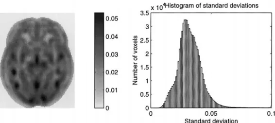 FIG. 2. Typical estimates of standard deviations from a VBM study. On the left is a single plane showing standard deviations