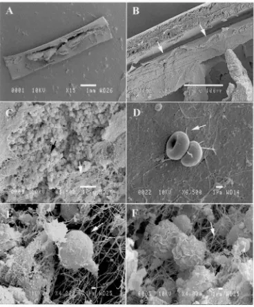 FIGURE 3.2. Scanning electron micrographs of implanted encapsulated olfactory ensheathing cells 
