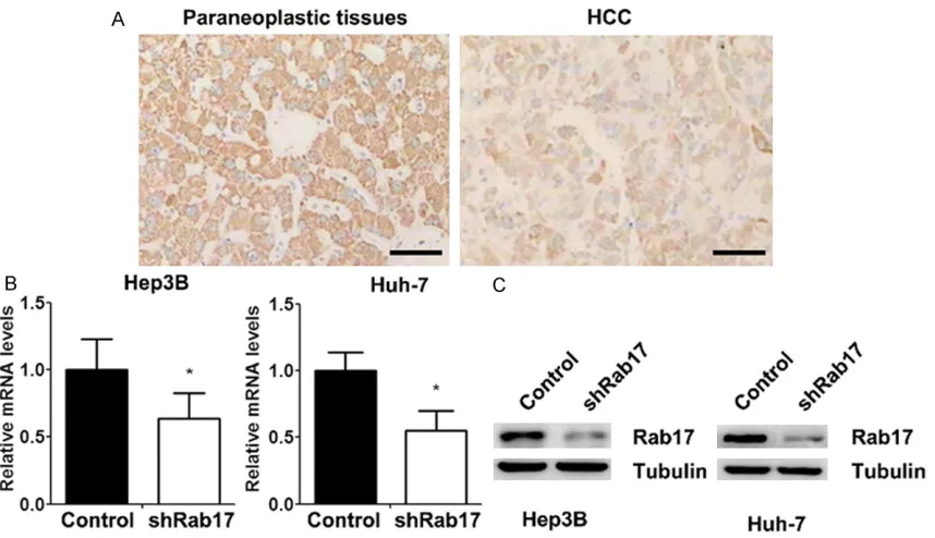 Figure 1. Generation of Rab17 low-expressing HCC cell lines (Hep3B and Huh-7). A. Expression of Rab17 in para-neoplastic tissues and HCC revealed by immunohistochemistry (scale bar = 100 μm)