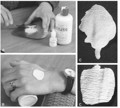 Figure 2. Making a silicon skin surface cast. The research assistant mixes siliconwith catalyst (A) and applies it on the left hand of the participant (B)