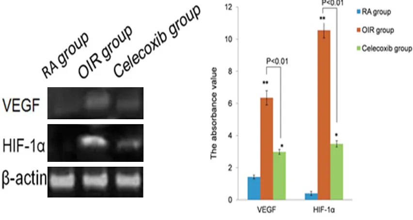 Figure 4. HIF-1α and VEGF mRNA expression in all the groups were detected by RT-PCR. There was marked elevated of HIF-1α and VEGF mRNA in ROP mice compared with those of the RA group (**P < 0.0.01)