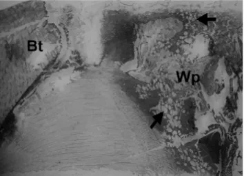 FIG. 6–Radial longitudinal section through a 2-year-old pruned branch wound (Bt) inE. globulus, showing wound-associated phloem (Wp) containing abundant oil glands(arrows) (from Eyles et al