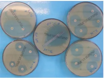 Figure 5.2 Agar disk diffusion and E-test of streptococcal isolate 