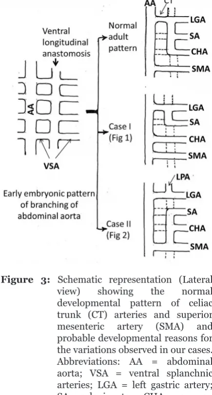 Figure  3:  Schematic representation (Lateral 