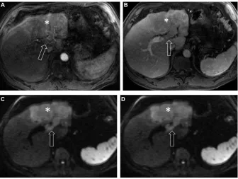 Table 4 Examples of definitely benign (category LR-1) and probably benign (category LR-2) lesions