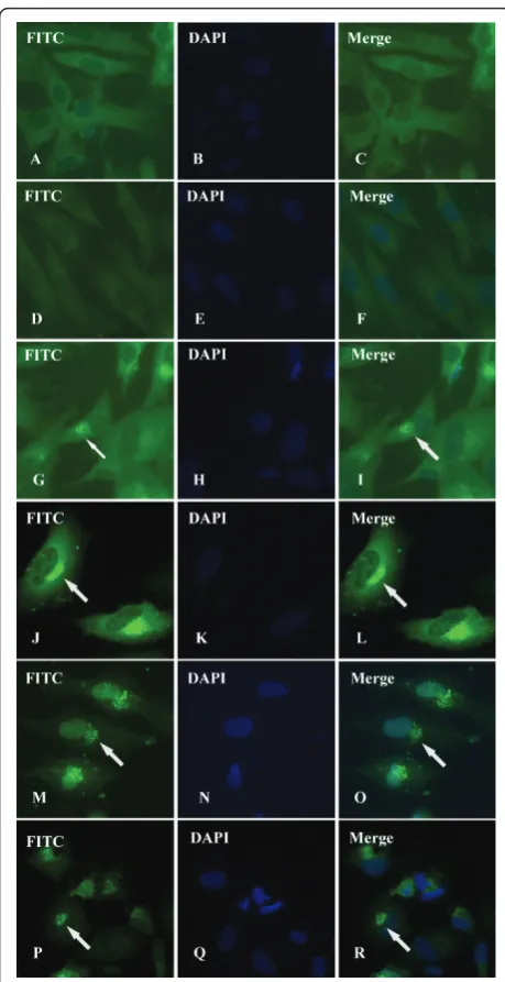Figure 5 Intracellular location and distribution of DEV gI proeinanalyzed by IIF. Mock-infected (A-C) and DEV-infected (D-R)