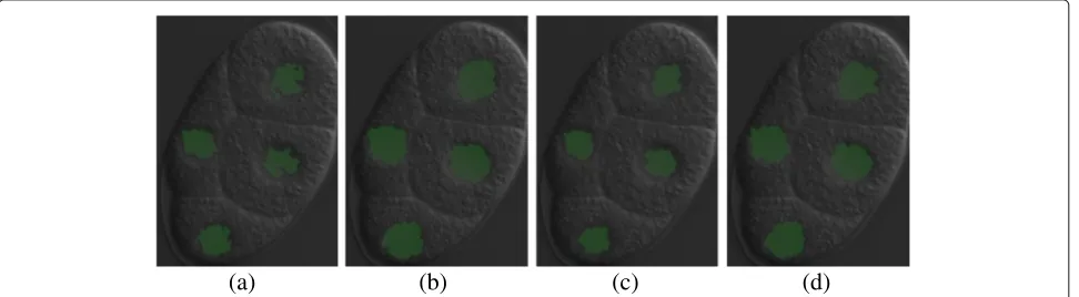 Fig. 9 Comparison of the detected nuclear regions with/without DRLS refinement. a The initial segmentation using simple thresholding on themiddle Z-slice (initial LSF)