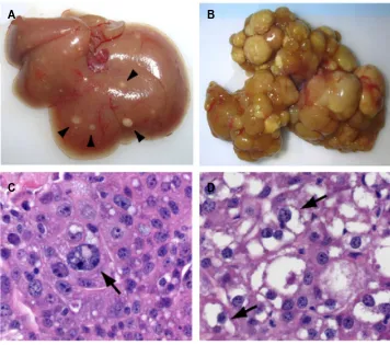 Figure 3 Hepatocellular carcinoma development following YAP induction in a transgenic murine model.Note: (A) Liver from YAP transgenic mouse model