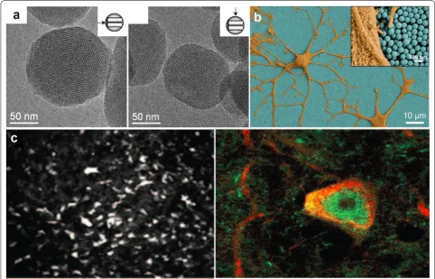 Fig. 3 Silica nanoparticles (SiNPs). a Transmission electron microscopy images of mesoporous silica nanoparticles, acquired parallel (left) or perpen-dicular (right) to the long axis of the mesoporous channels
