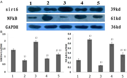 Figure 1. mRNA Expressions of SIRT6 and NF-Κb, A: SIRT6 mRNA expression; B: NF-κB mRNA expression