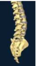 Figure 9. L4 and L5 vertebrae 