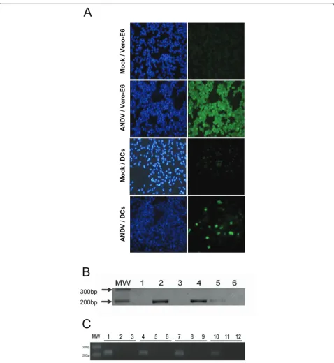 Figure 1 Detection of ANDV infection of primary human dendritic cells. (A) Vero E6 epithelial cells and human immature DCs infected withADNV (strain CHI-7913)