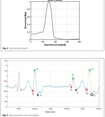 Fig. 3 Beat properties (not normalized)