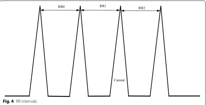 Fig. 4 RR intervals