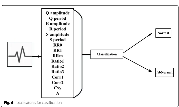 Fig. 5 QRS summits periods