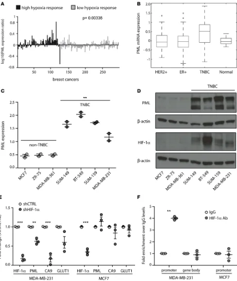 Figure 1. PML is regulated by HIF1A in TNBC. (PA) PML mRNA expression (centered by mean and log10 transformed) in 295 early-stage breast cancer samples subcategorized for high and low expression of a hypoxia-responsive gene signature of 123 common hypoxia-