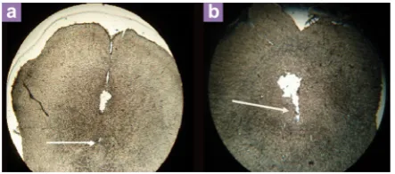 Figure 1: Location of electrode (a) and cannula (b) in the DRN of rats used in the stimulation studies and reversible inactivation after using lidocaine