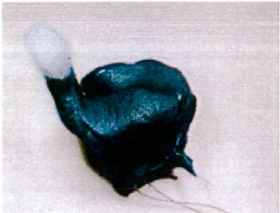 Fig. 2.1 Ear impression, cotton block in place 
