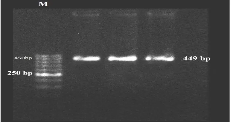 Figure 1: The selection subregion of primers and their sequencing 