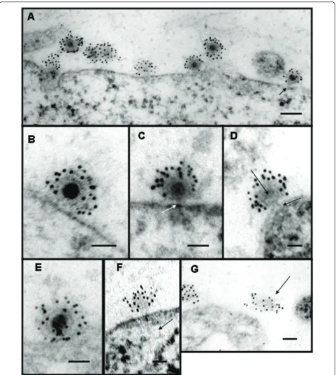 Figure 2 Electron micrographs of thin sections of Sindbis virus-cell complexes at pH 7.2