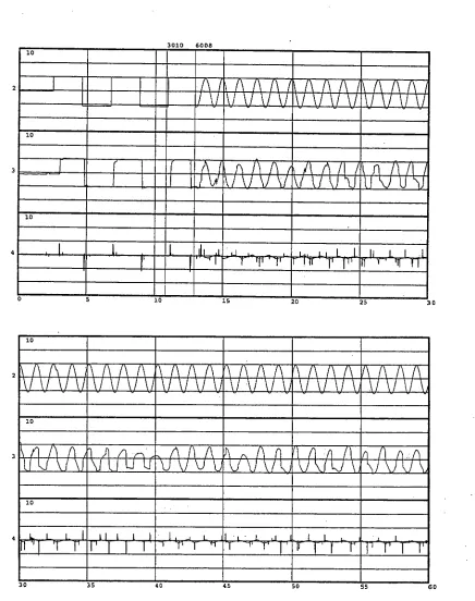 Figure 8. Recording of 60 seconds of eye movements during Imaging + EMs task, 