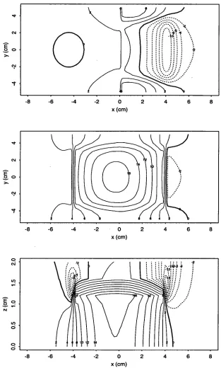 Figure 5.4: Contour plots of ST potential on the epicardium (top), the endocardium 