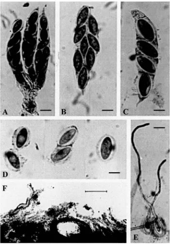 Fig. 1.4--6: Wuestneia epispora 