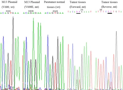 Figure 3. BRAF mutation by DNA sequencing. Sequence chromatogram of PCR (exon 15) product from two M13 recombinant plasmids, one for V600 wild type and the other for V600E mutation, used as negative and positive controls respectively