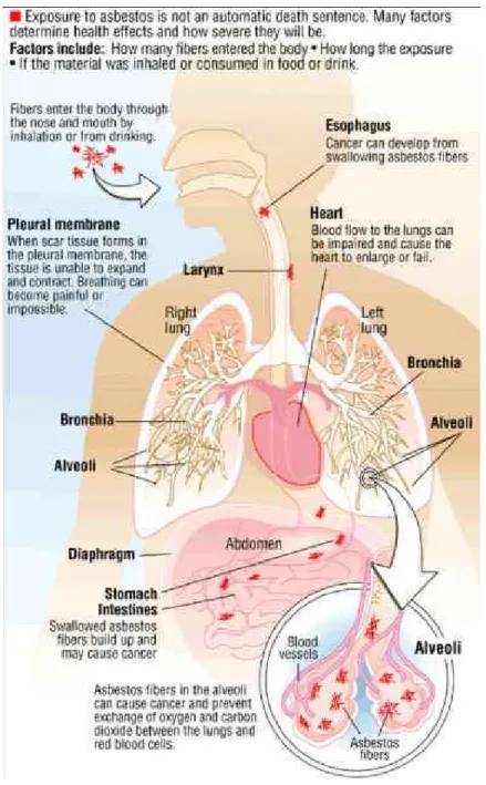 Figure 4: Shows areas of the body that can be affected by Asbestos. 
