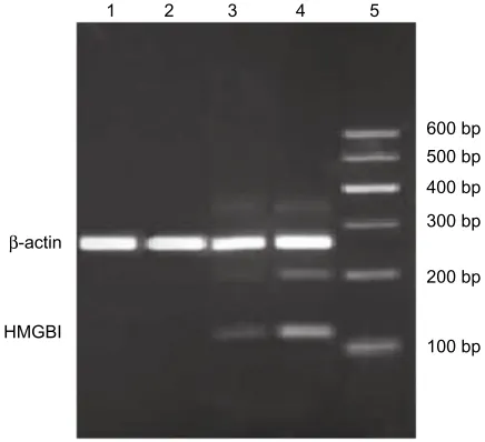 Figure 1 expression of high-mobility group box 1 mRna in peripheral blood mono-nuclear cells by real-time polymerase chain reaction analysis.Notes: Total Rna was obtained from peripheral blood mononuclear cells of the control group and from acute obstructi