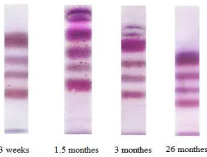 Figure 4. Spectrum of aldo-keto reductases (point out the number of from total aldo-keto reductase activity)
