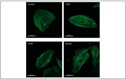 Figure 2.2 Representative example of SsnB effect on cytoskeletal organization of  
