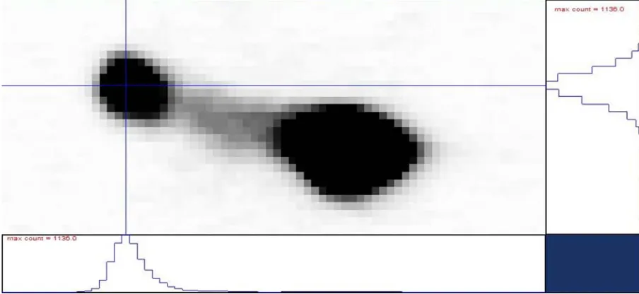 Figure 4. Stationary diffraction spot as triplet from crystal A taken at the position close to 111 Bragg reflection