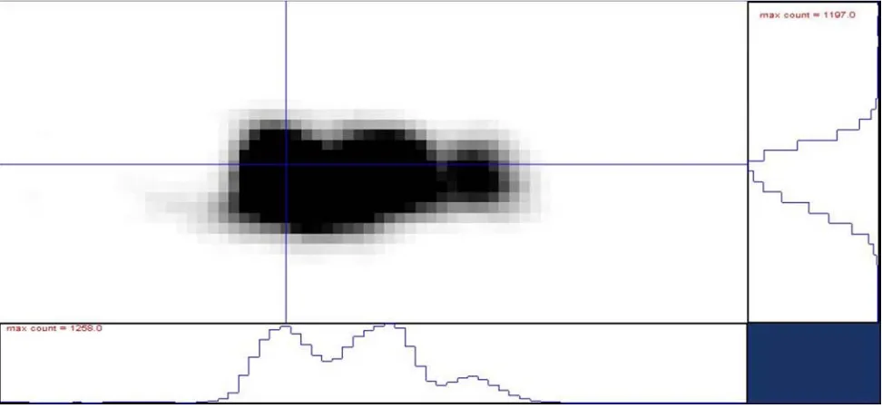 Figure 6. Oscillation (within 10°ω ) image of 220 reflection from crystal A. One wide spot has maximum at 75.220° 2θ / 1.262 Å, FW 0.5 M= 0.27° 2θ, the width at spot edges ≈ 3° 2θ