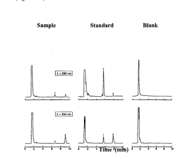 FIGURE 11.7: Typical chromatograms of thiopentone in plasma, standard and blank 