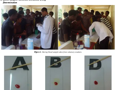 Figure 4. During blood sample taken from voluntary students. 