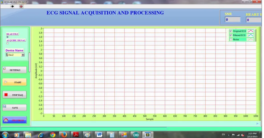 Figure 4. The main graphic user interface of the ECG signal acquisition and processing software module (the left of the main graphic user interface are function menus, user can adjust the scale display window by double click maximum value of vertical or ho