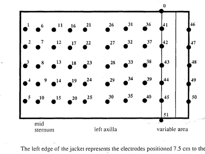 Figure 1: The configuration of the electrode jacket. 