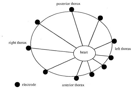 Figure 2 : Position of the electrodes around the  