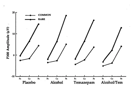 Figure 4:  P300 amplitude for both common and rare stimuli at each site for all 